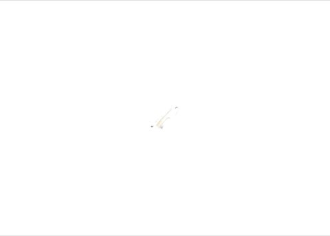 Bosch 1 987 475 287 Brake Shoe Fitting Kit